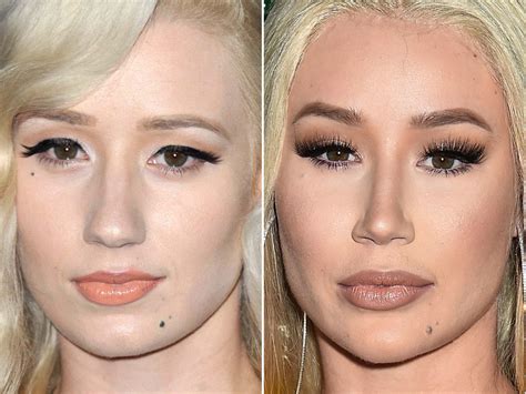 iggy azalea tits|Iggy Azalea Plastic Surgery EXPLAINED! (Before & After 2021).